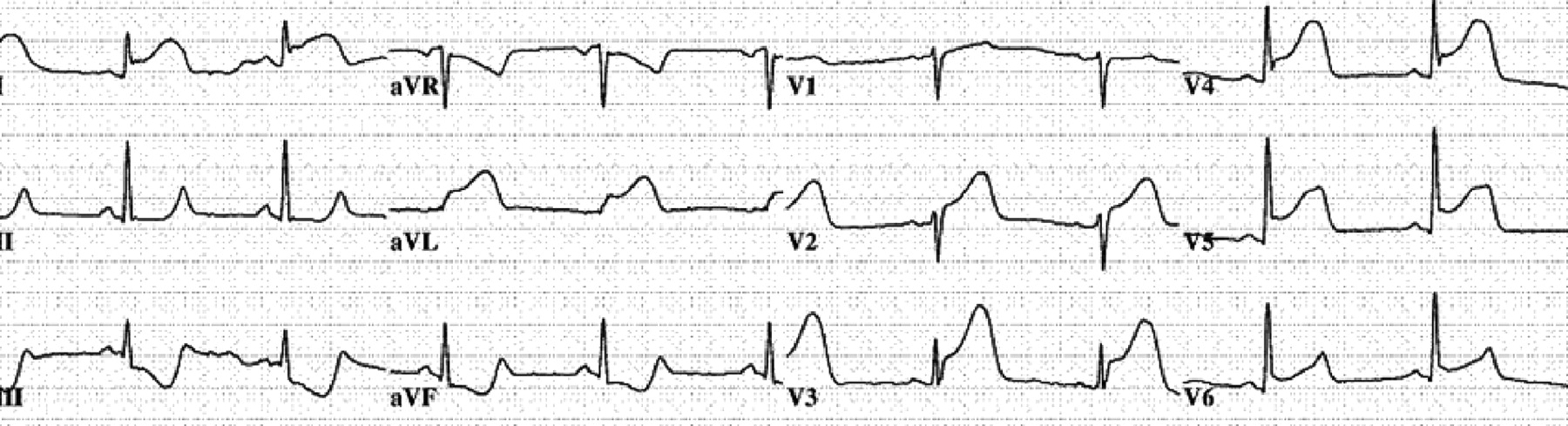 AHA ECG Guidelines Graphic